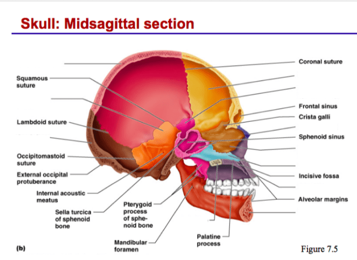 Midsagittal