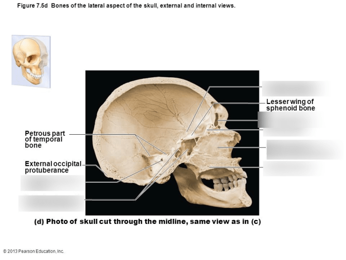 Midsagittal section of the skull